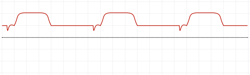 Continuous Positive Airway Pressure (CPAP)