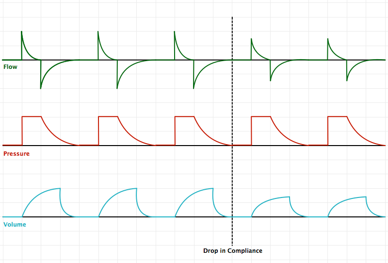 Pressure Control (PC)