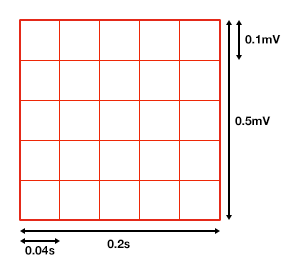 The ECG grid