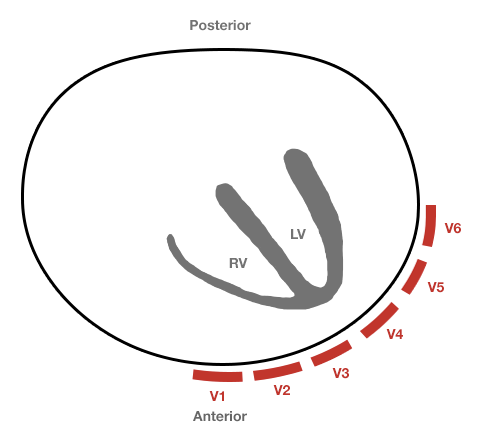 Precordial Leads