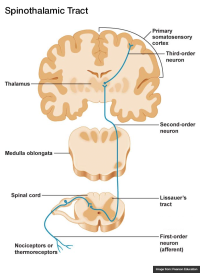 Spinothalamic Tract - Differential Diagnosis of