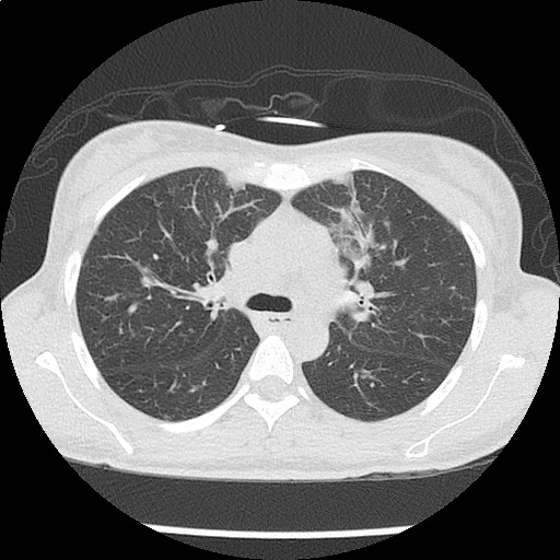 Endocrine Emergencies