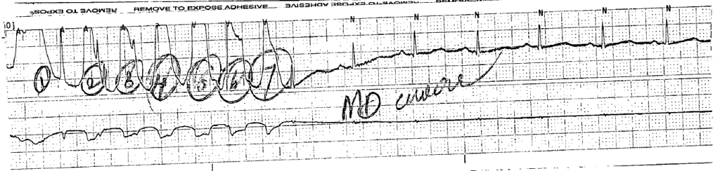 VT on Telemetry