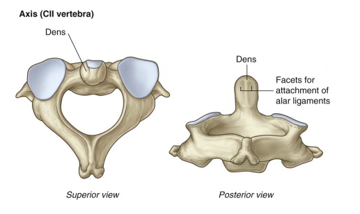Axis (C2 vertebra) - Differential Diagnosis of
