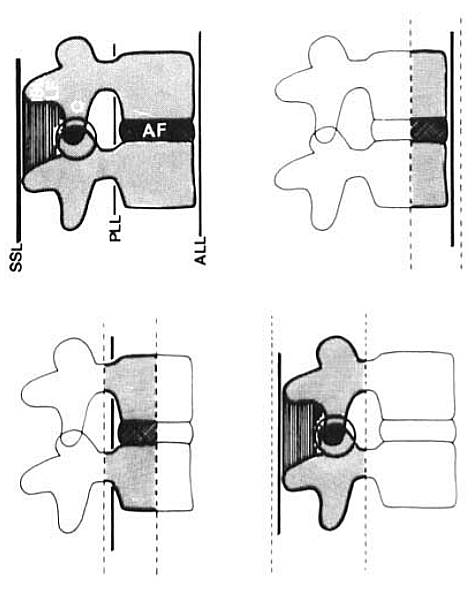 Vertebral Columns