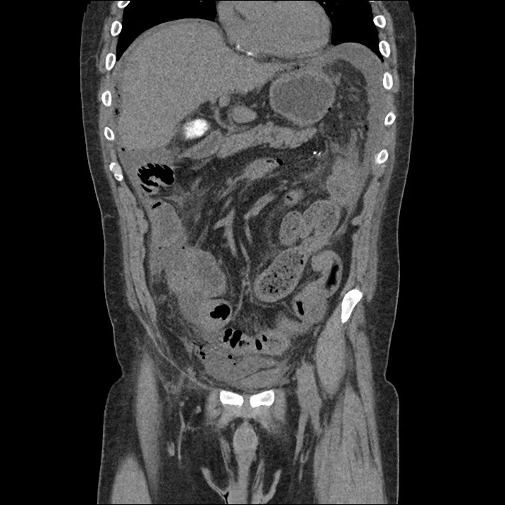 differential-diagnosis-of-hypotension