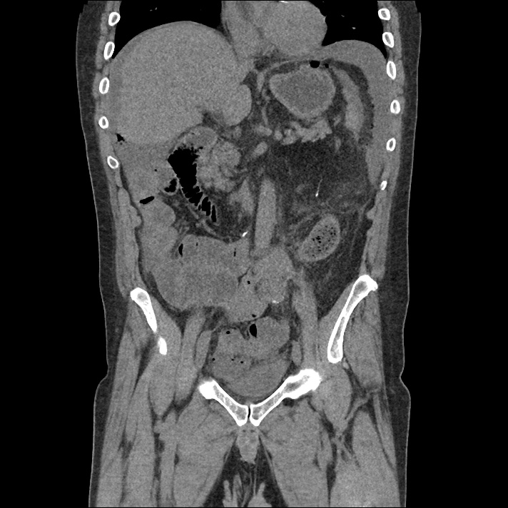 differential-diagnosis-of-hypotension