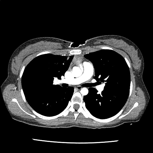 Differential Diagnosis of Blunt Cardiac Injury