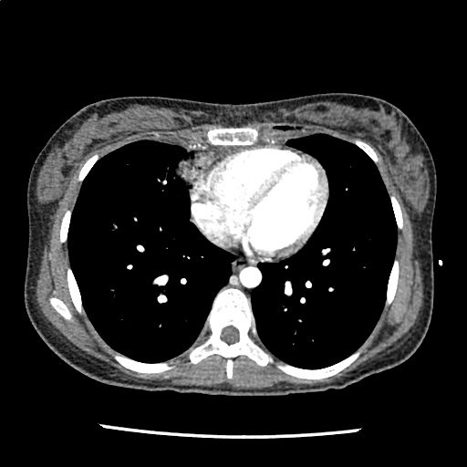 Differential Diagnosis of Blunt Cardiac Injury