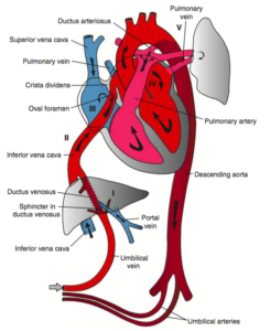Fetal Circulation - Differential Diagnosis of
