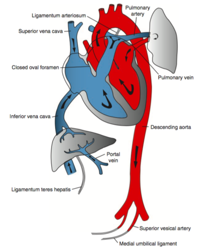 Neonatal Circulation - Differential Diagnosis of