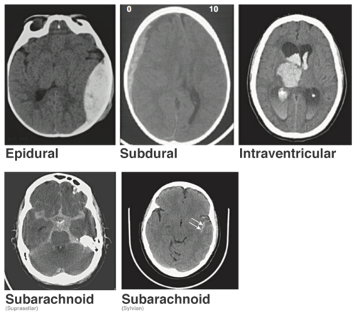 A Systematic Approach to the Interpretation of CT Head