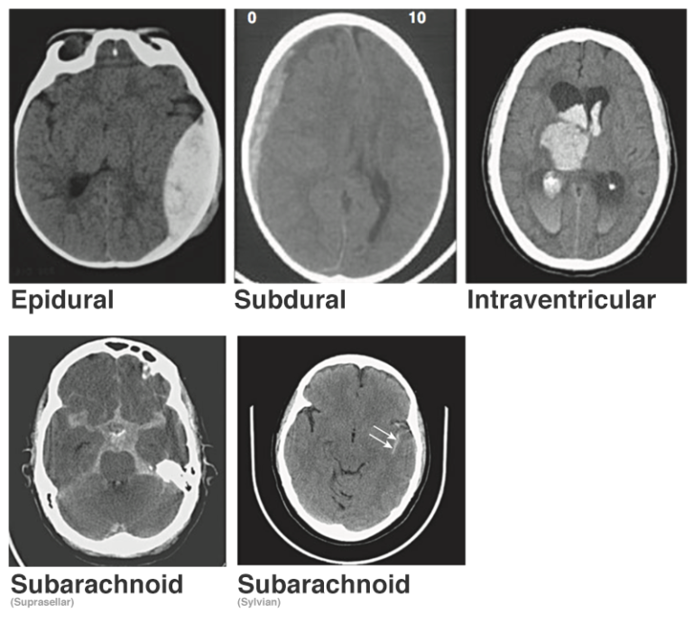 blood_location - Differential Diagnosis of