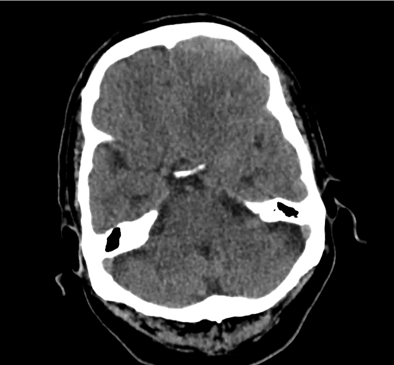 ct-sdh_02