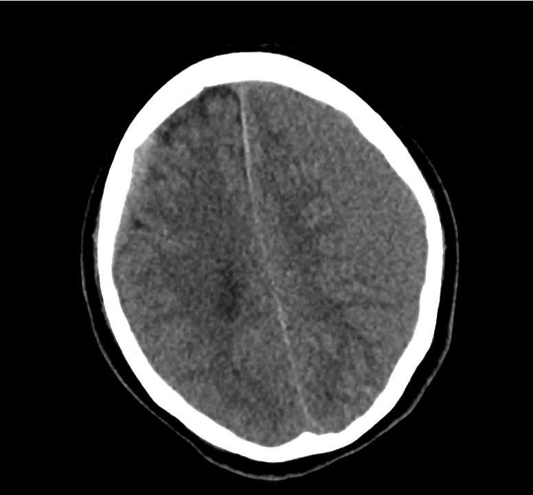 ct-sdh_13