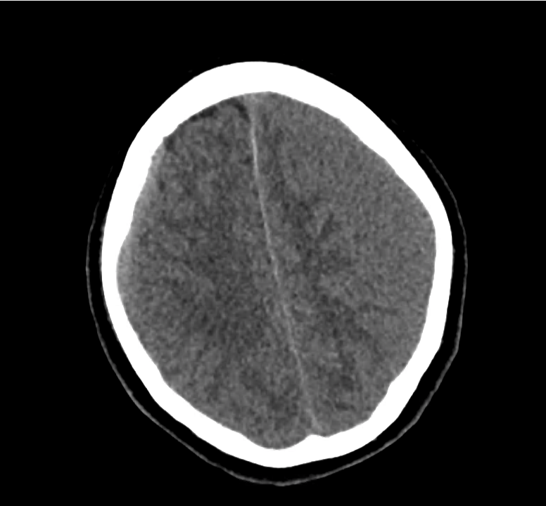 ct-sdh_14