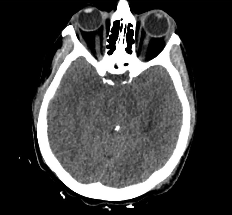 ct-trauma_11