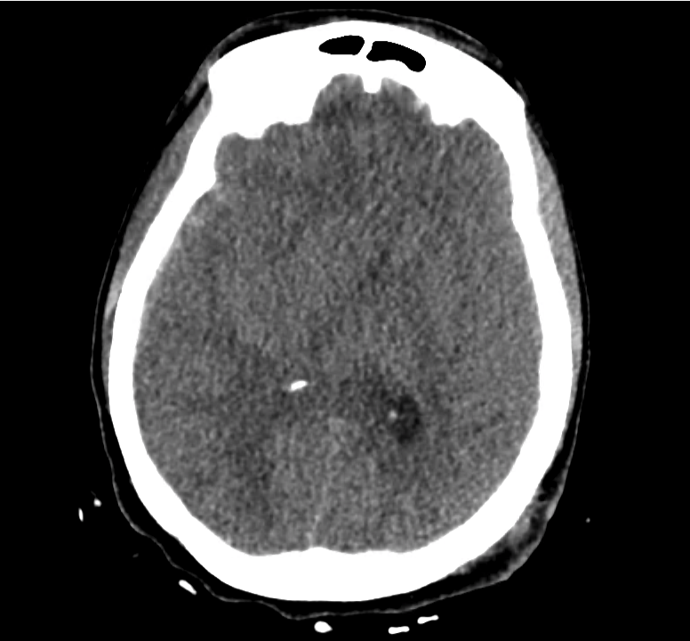 ct-trauma_15