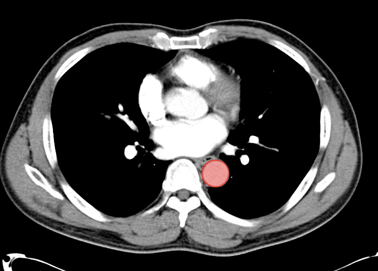 A Systematic Approach To The Interpretation Of Ct Abdomen Pelvis