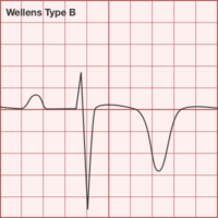 Differential Diagnosis of ECG Guide: Part II