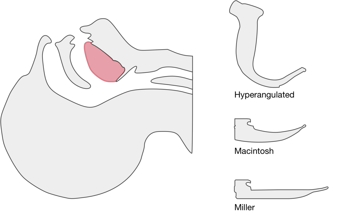 Differential Diagnosis of Technique for Video Laryngoscopy