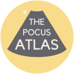 The POCUS Atlas