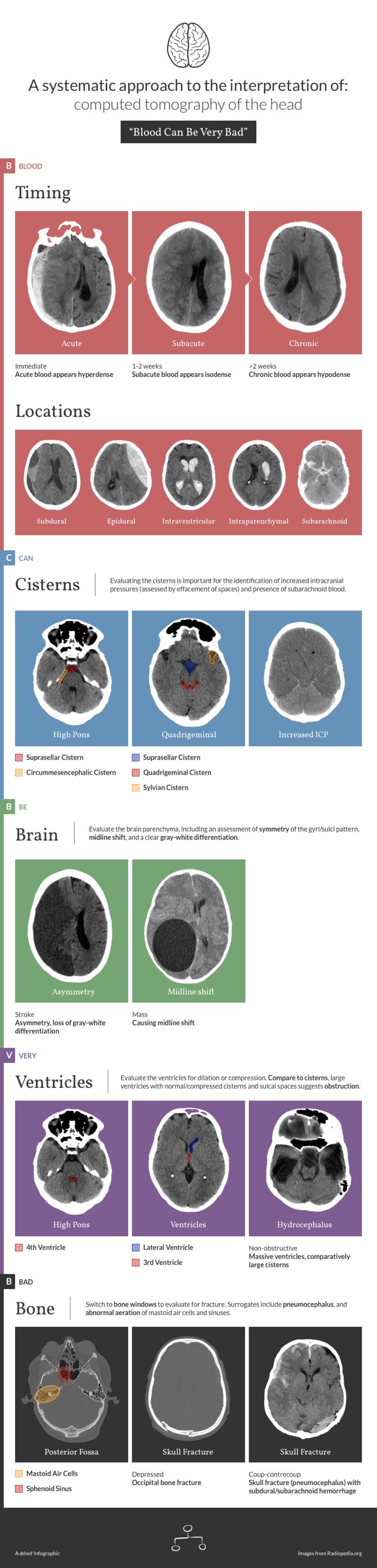 Differential Diagnosis Of Infographic Ct Head Interpretation