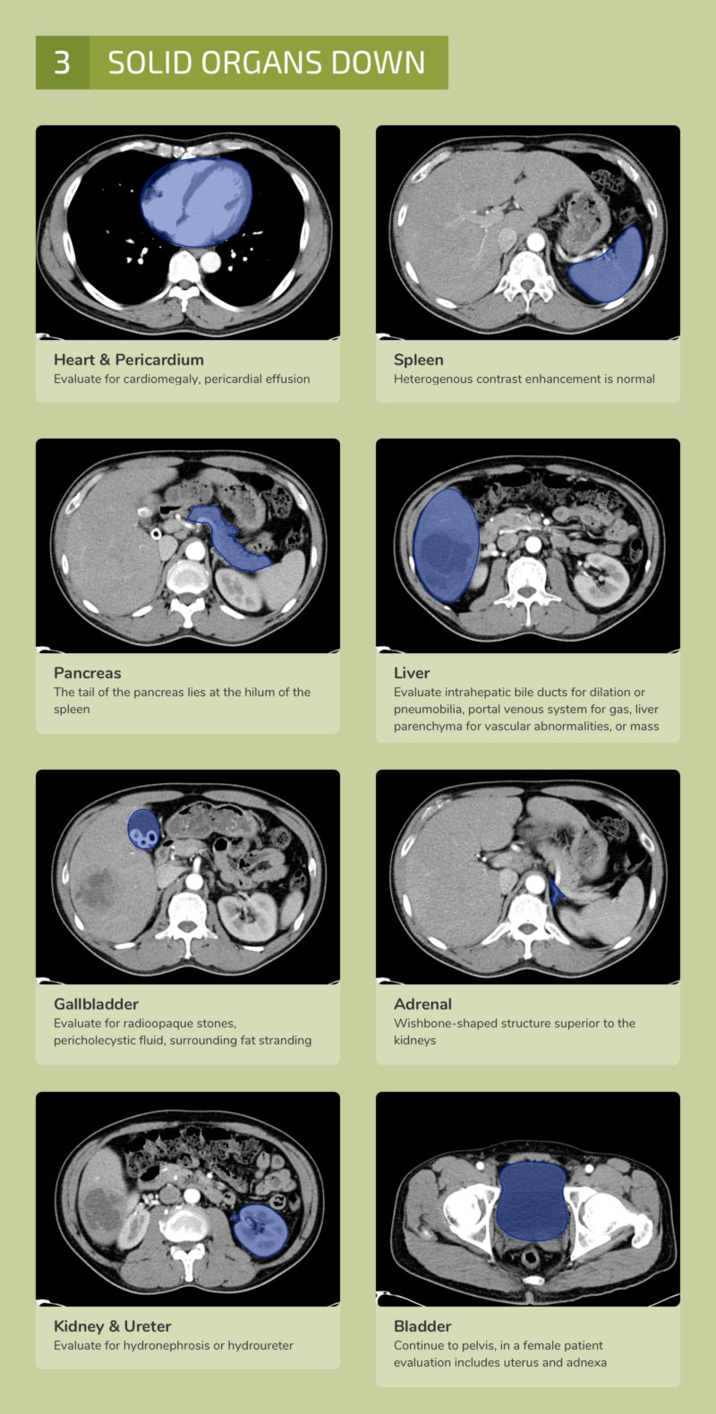 Differential Diagnosis of Infographic: CT Abdomen/Pelvis Interpretation