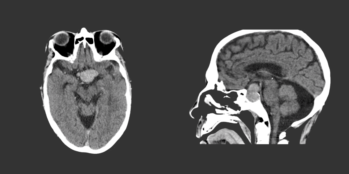 BLOOD TESTING FOR SEIZURE MEDICINE intelligence overview