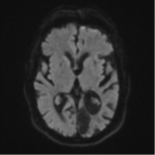 Differential Diagnosis of Numbness