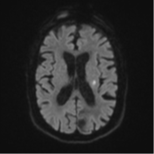 Differential Diagnosis of Numbness