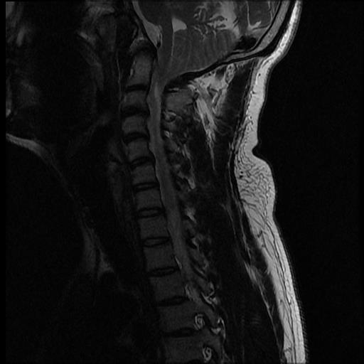 Differential Diagnosis of Numbness