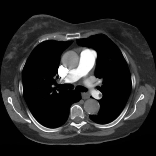 03_pe - Differential Diagnosis of