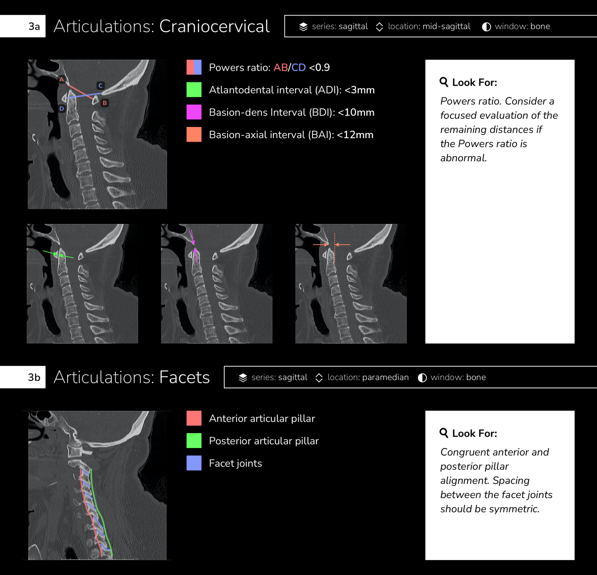 Differential Diagnosis of Infographic CT Cervical Spine Interpretation