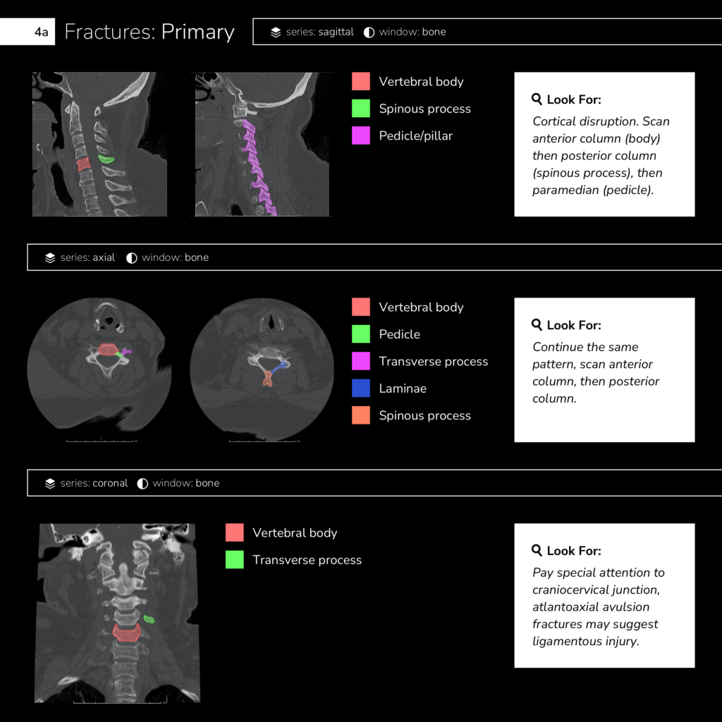 Fractures: Primary