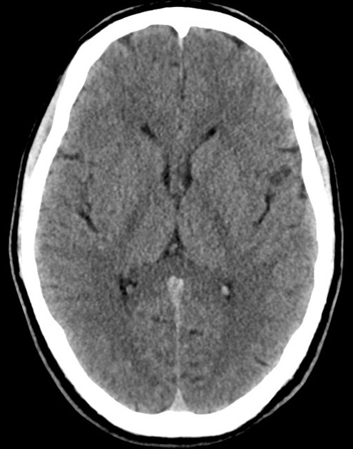 altered mental status differential