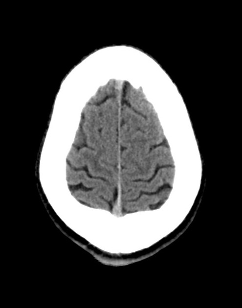 altered mental status differential