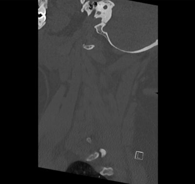 01 - Differential Diagnosis of
