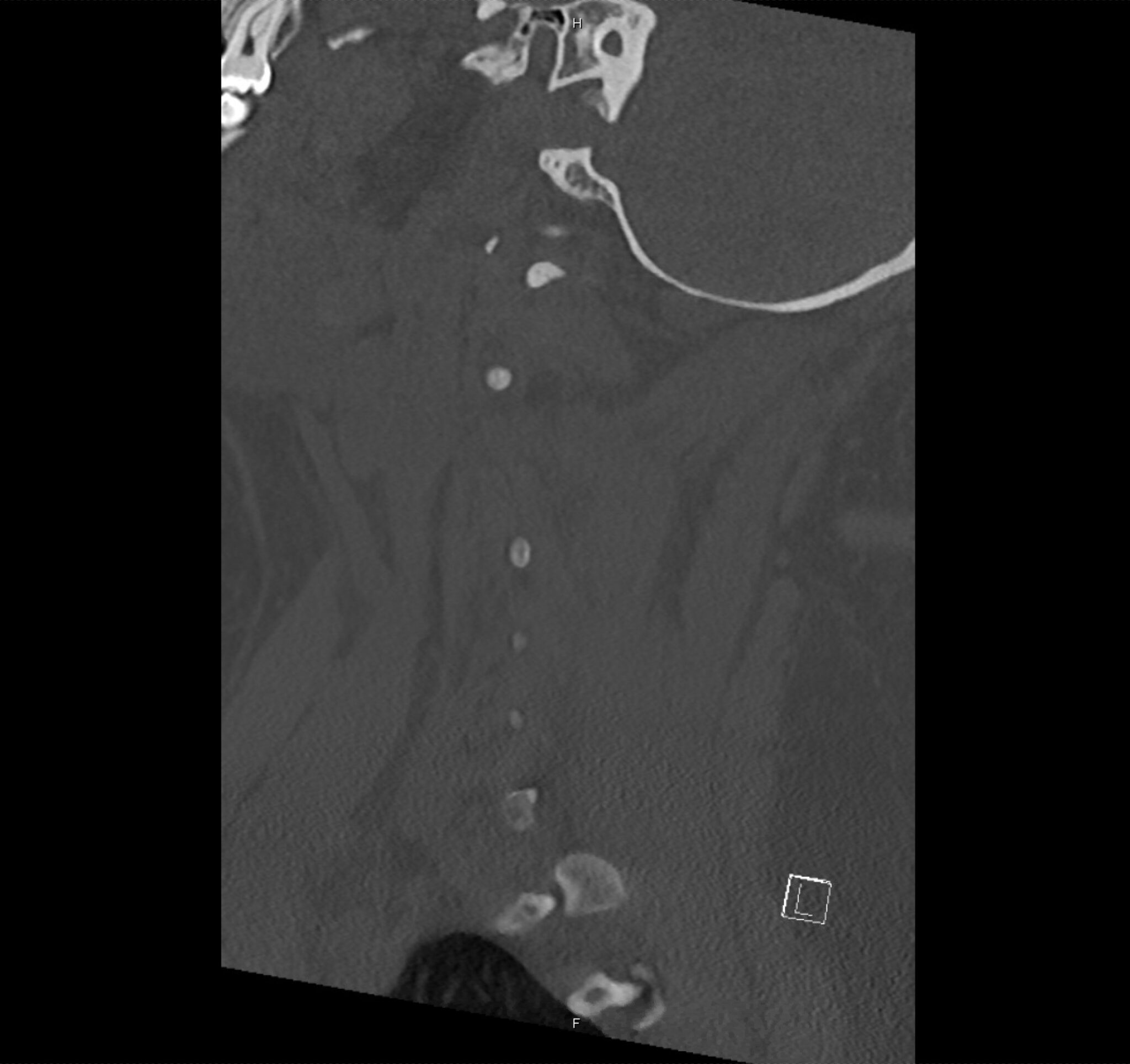 04 - Differential Diagnosis of