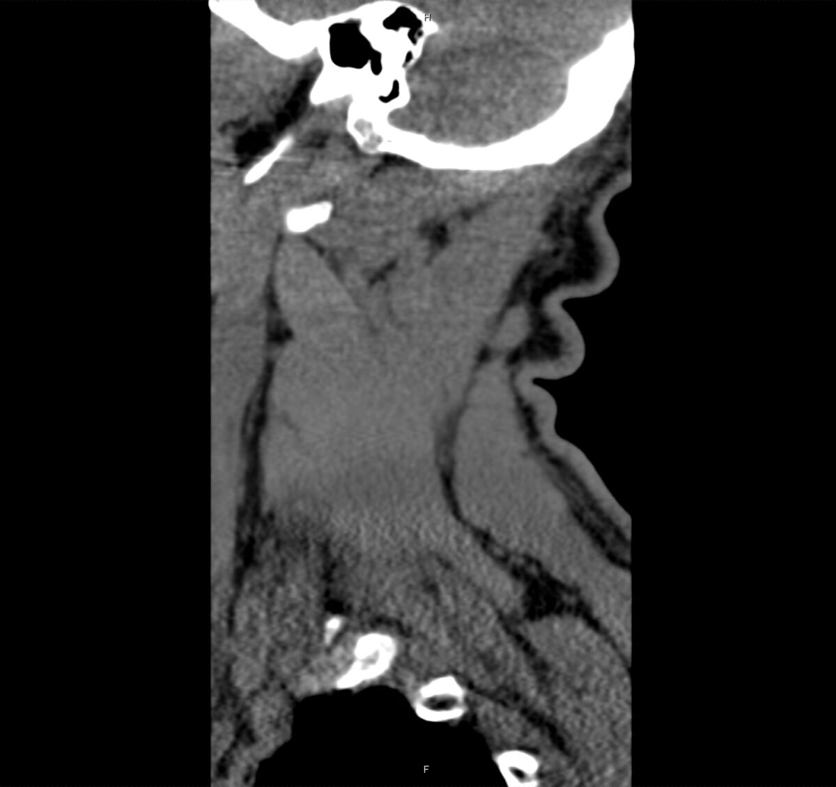 02 - Differential Diagnosis of