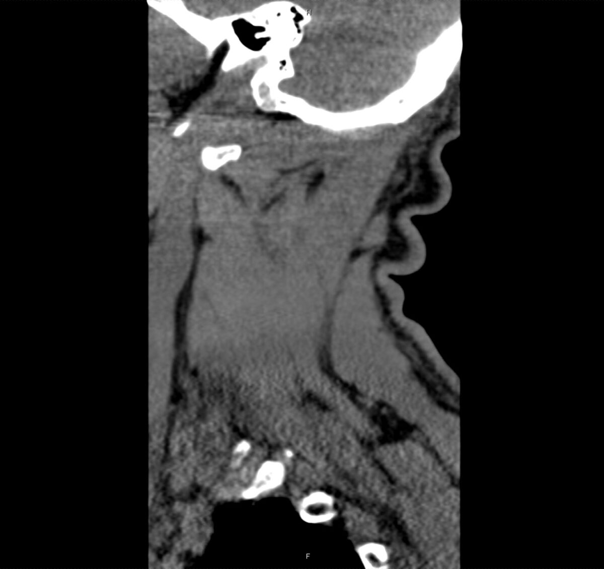 03 - Differential Diagnosis of