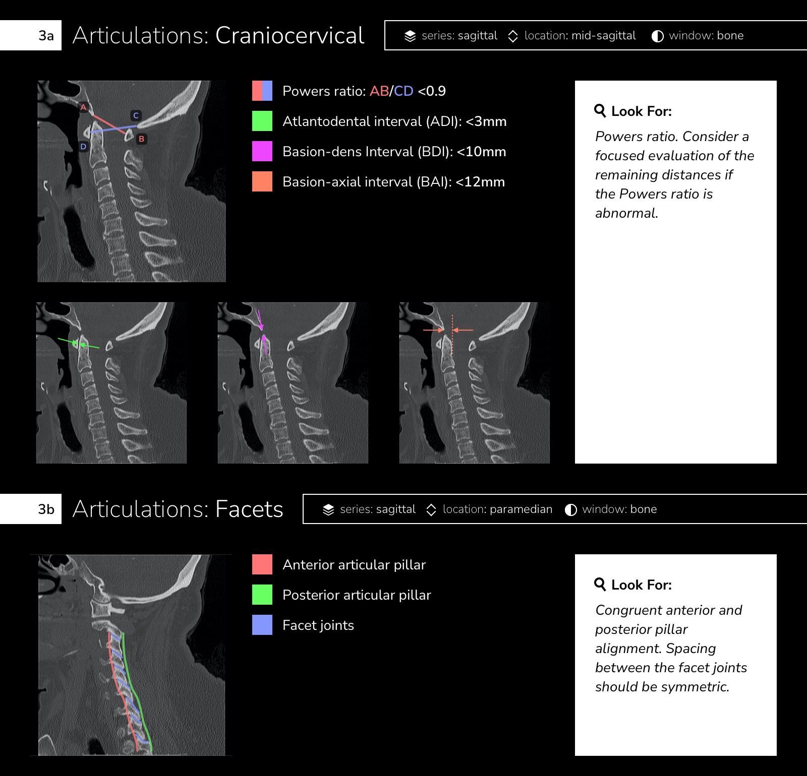 Infographic: CT Cervical Spine Interpretation