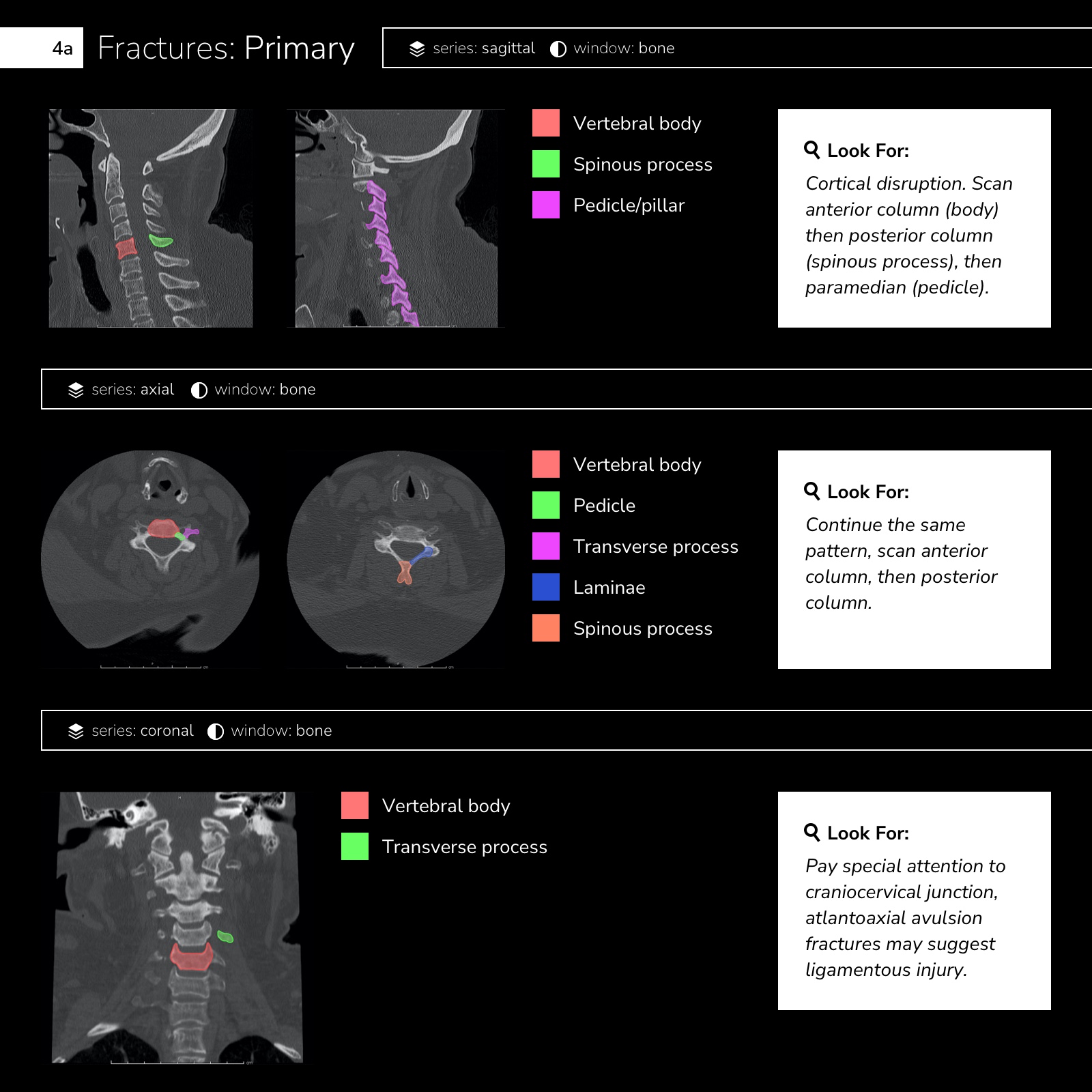 Infographic: CT Cervical Spine Interpretation