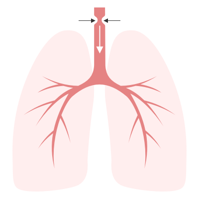 Dyspnea Tags - Differential Diagnosis of