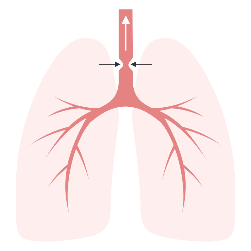 Differential Diagnosis Of Wheezing And Stridor